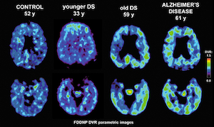 Illustration for article titled Can Science See Inside An NFL Player's Skull Before It's Too Late?